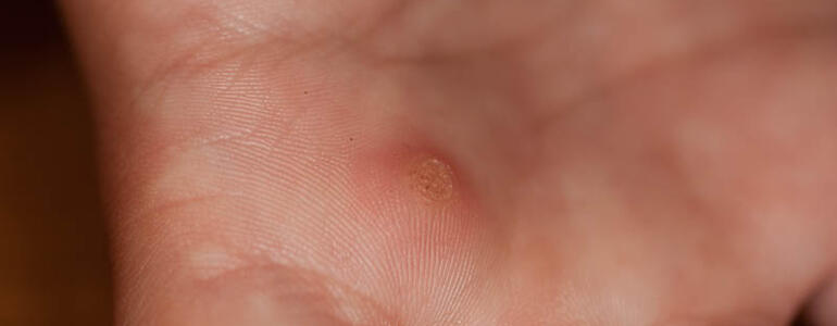 dictionar-de-vise-neg