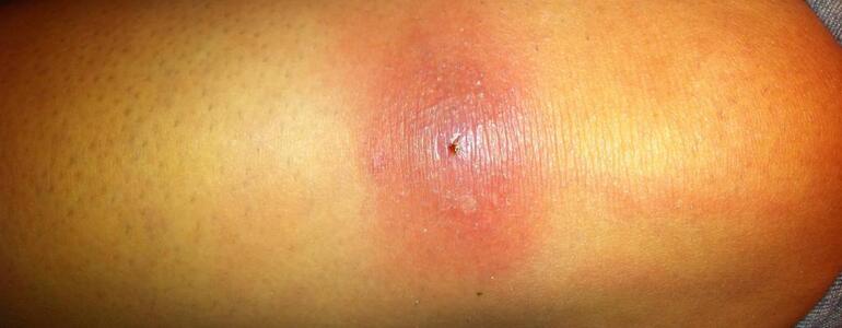 dictionar-de-vise-buba